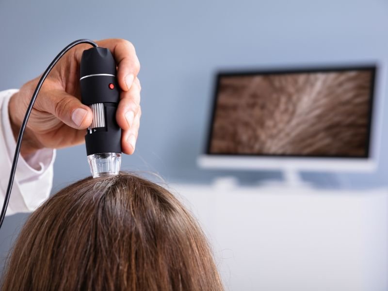 Consulta Clinica com Anamnese e Tricoscopia Digital curitiba 1