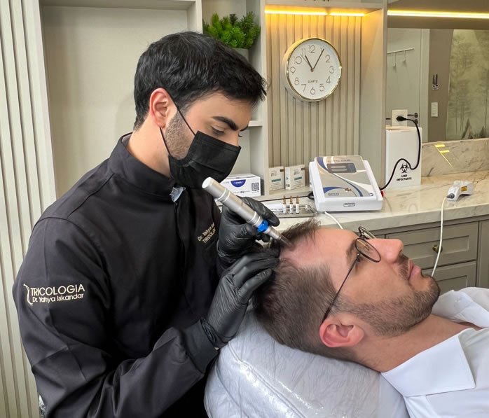 tratamento de queda de cabelo em curitiba