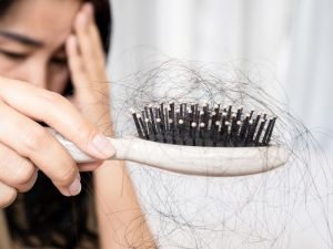 Tratamento de alopecia feminina em Curitiba