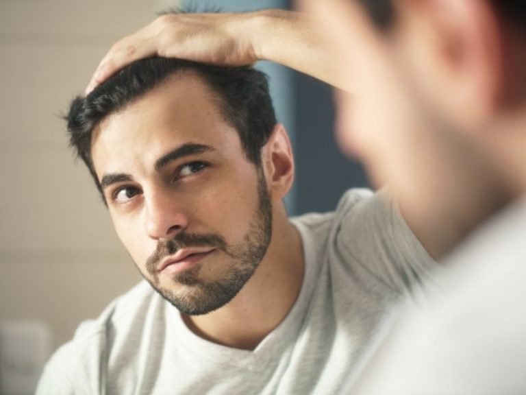 Alopecia masculina em Curitiba