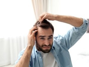 Alopecia areata em Curitiba