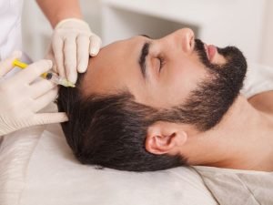 Tratamento de alopecia frontal fibrosante em Curitiba
