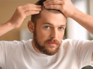 Calvície masculina em Curitiba