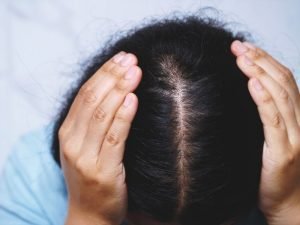 Dermatite atópica no couro cabeludo em Curitiba