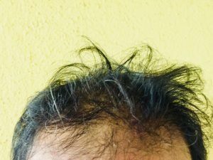 Tricodinia em Curitiba