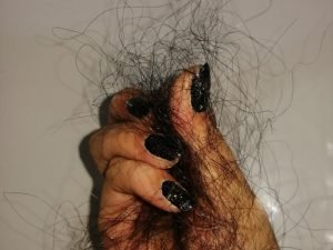 Reforço da densidade capilar em Curitiba