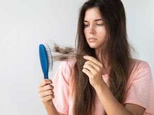 Queda severa de cabelo em Curitiba