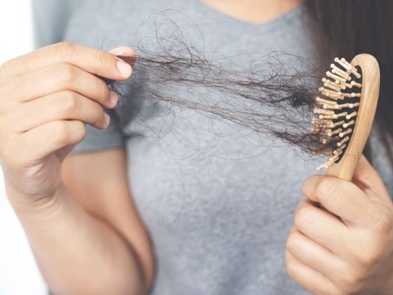 Queda de cabelo contínua em Curitiba
