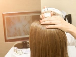 Terapia com laser capilar em Curitiba