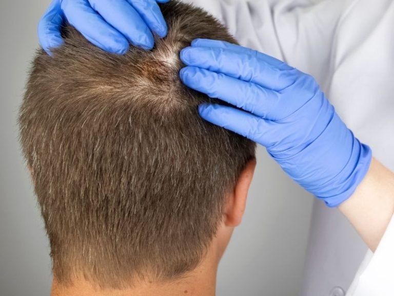 Tratamento com ativos concentrados para o cabelo em Curitiba