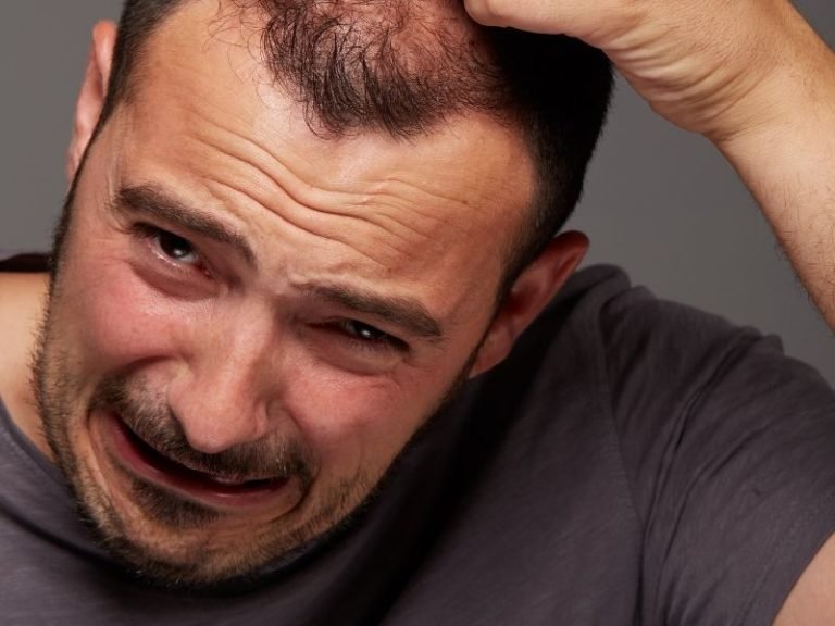Cuidados hormonais e capilares em Curitiba
