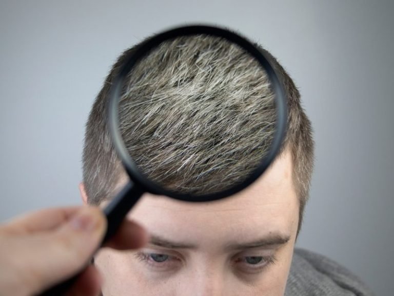 Atendimento com foco em saúde capilar masculina em Curitiba