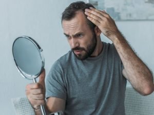 Terapia capilar em homens com calvície em Curitiba