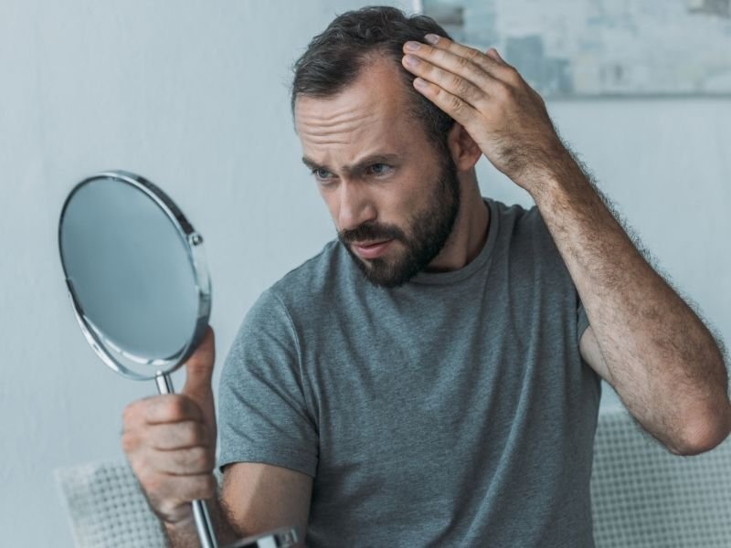 Terapia capilar em homens com calvície em Curitiba