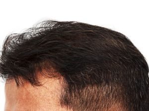 Tricologista em Curitiba: Uberaba