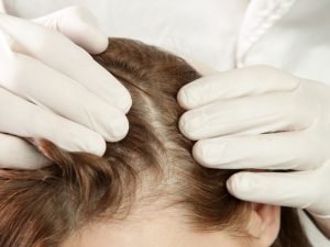 Crescimento de cabelo em Curitiba