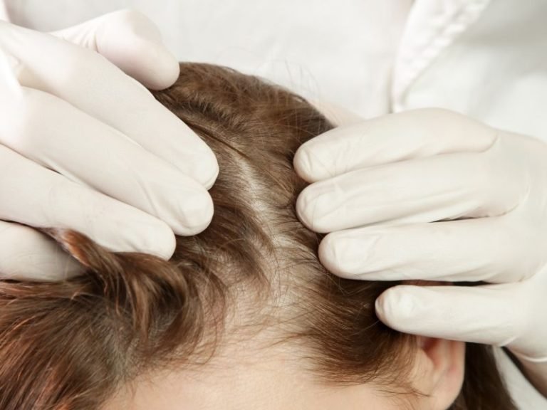 Crescimento de cabelo em Curitiba