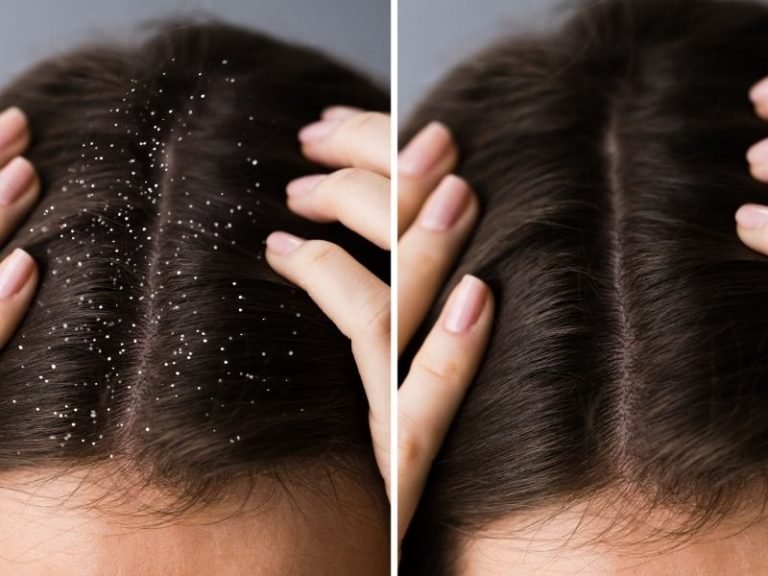Clínica de crescimento de cabelo em Curitiba