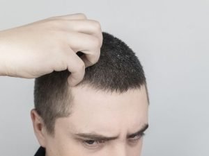 Tratamento de couro cabeludo sensível em Curitiba