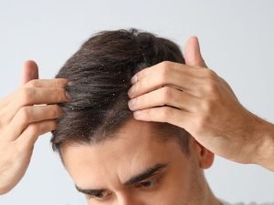 Tratamento de cabelos sem volume em Curitiba