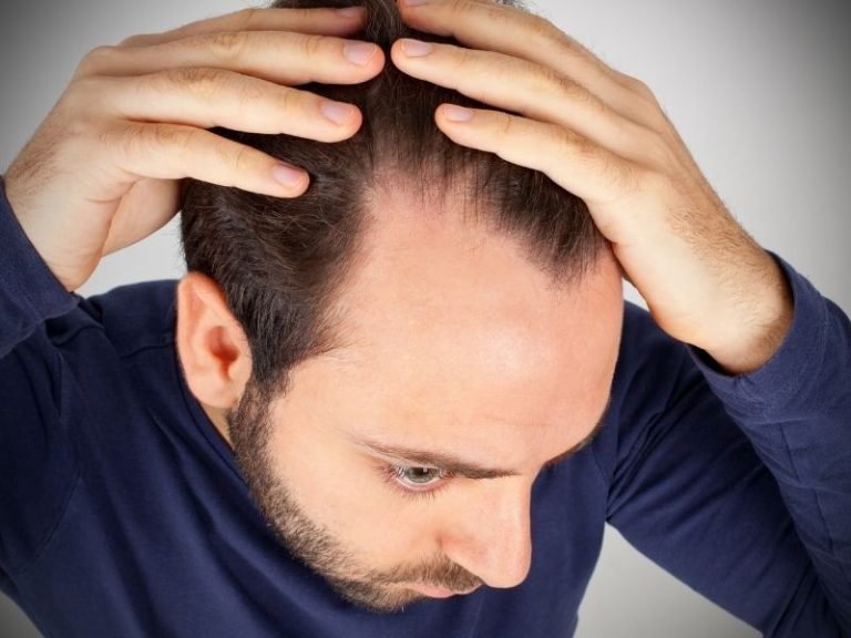 Cabelos sem volume com especialista em Curitiba