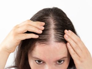 Consulta com tricologista em Curitiba