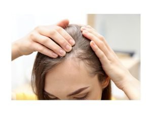 Tricologista para queda de cabelo em Curitiba