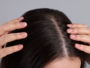 Especialista em alopecia areata em Curitiba