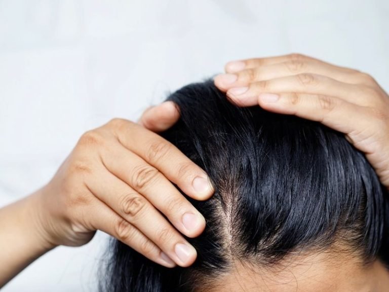 Especialista em dermatite seborreica em Curitiba