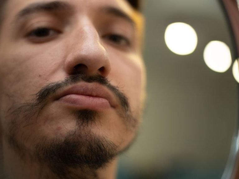 Especialista em falhas na barba em Curitiba