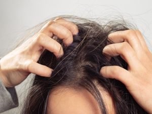 Especialista em intradermoterapia capilar em Curitiba