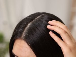Especialista em saúde capilar em Curitiba