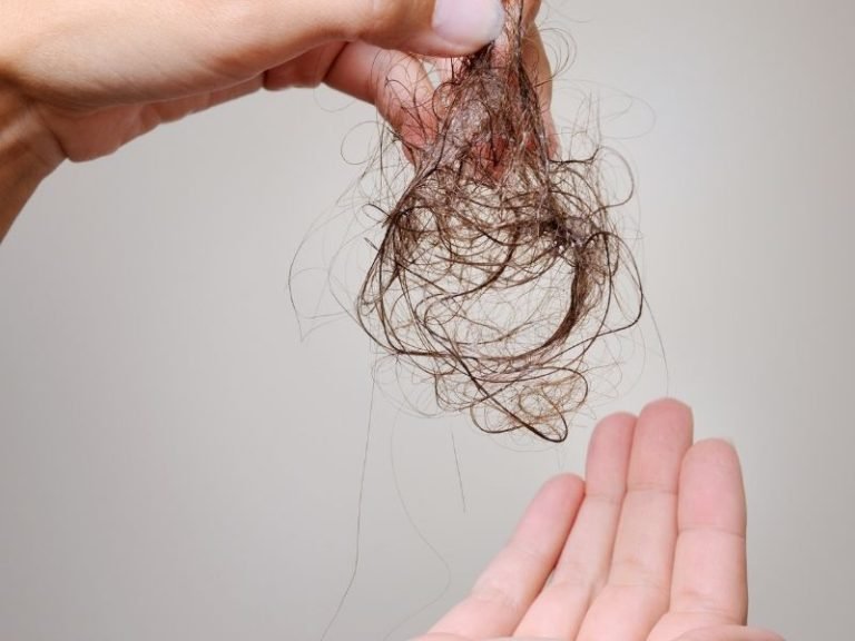 Clínica para queda de cabelo em Curitiba