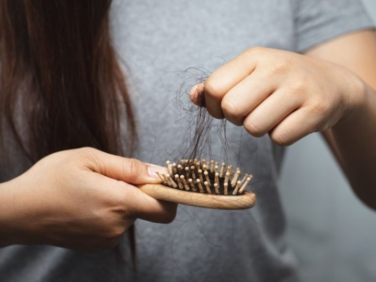Queda capilar por menopausa em Curitiba