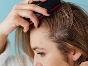 Alopecia em Curitiba