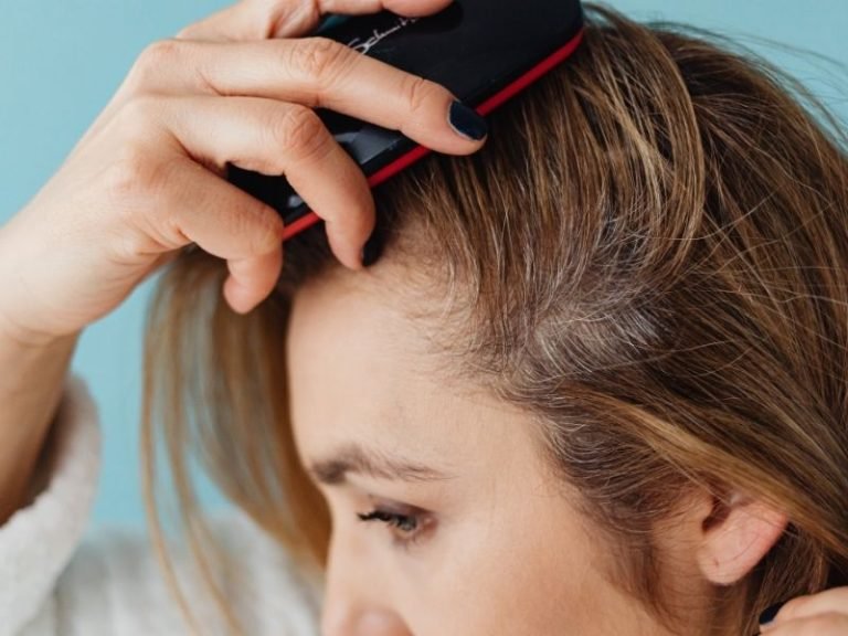 Alopecia em Curitiba