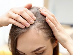 Tratamento de queda de cabelo em Curitiba