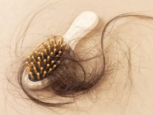 Clínica de queda de cabelo em Curitiba