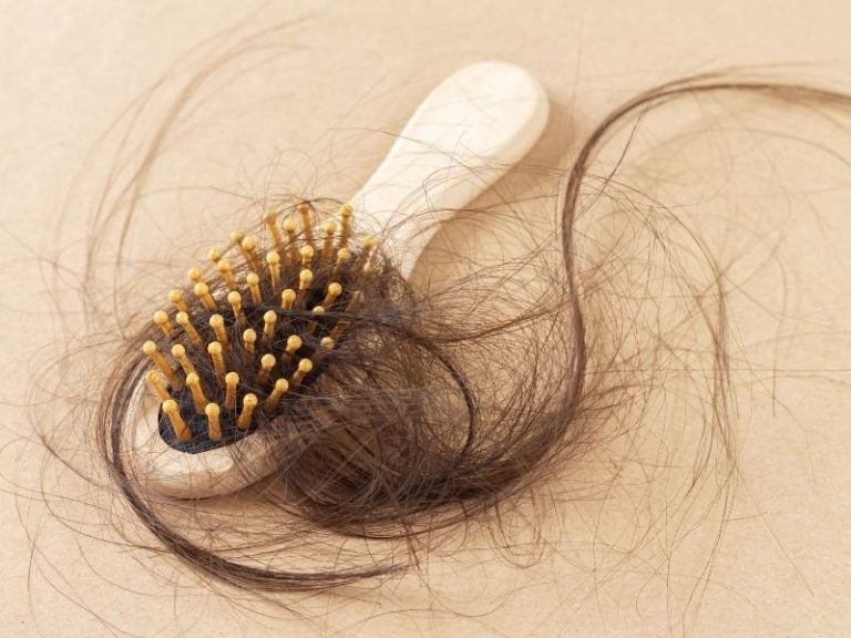 Clínica de queda de cabelo em Curitiba