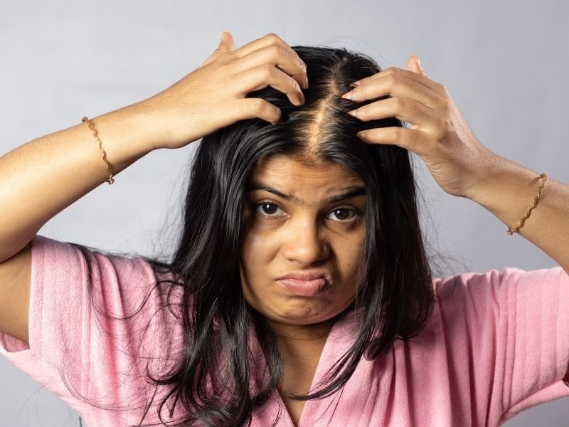 Alopecia androgenética com especialista em Curitiba